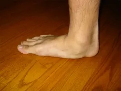 Flatfoot1.jpg