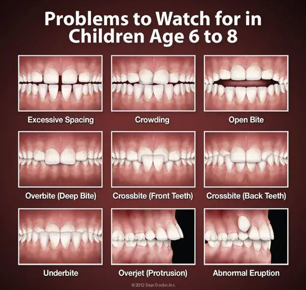 Kids mouth anatomy.