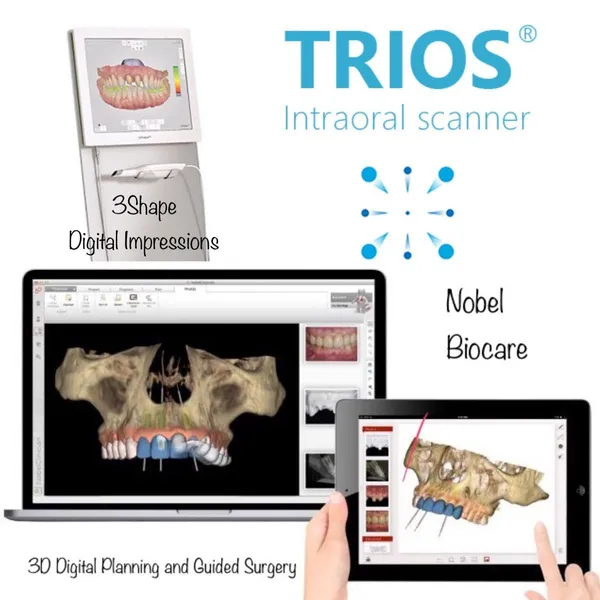 Trios Intraoral Scanner