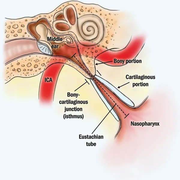 hearing loss treatment 3