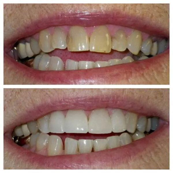 Portfolio Dentist El Paso, TX Rise Dental