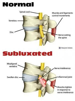 What are VSC and NIS?