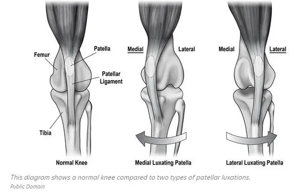 Patella