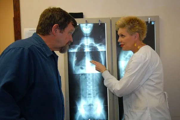 Doctor looking at spine xray