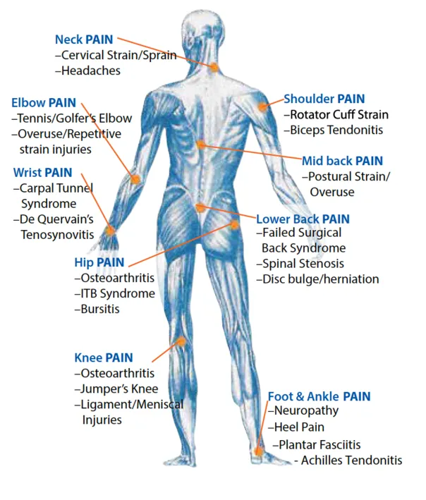 Body Pain chart