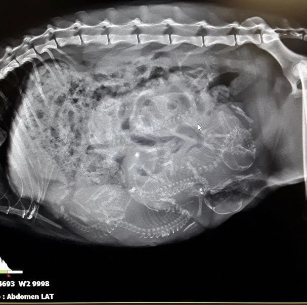 pregnancy radiograph