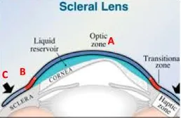 Scleral