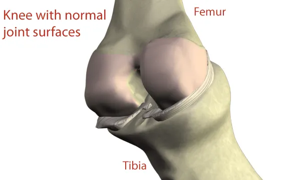 knee supartz injections. Example of a knee with normal joint surfaces