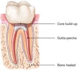 tooth