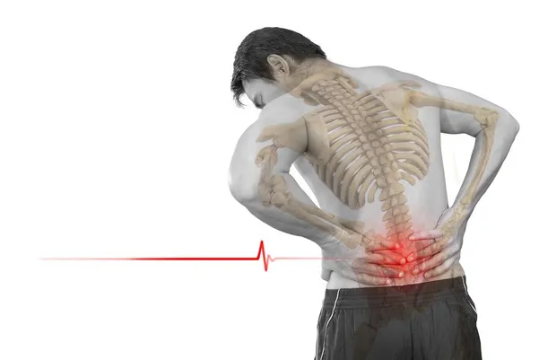 Back Pain