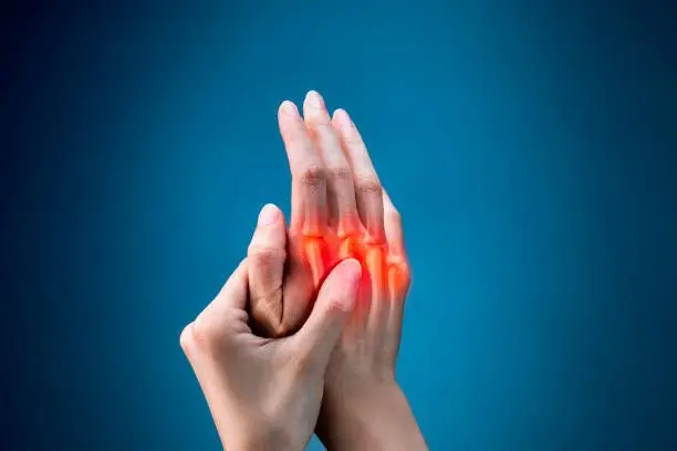 Medical image of a hand with a damaged joint