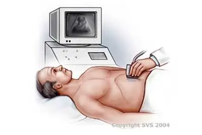 Duplex-Ultrasound