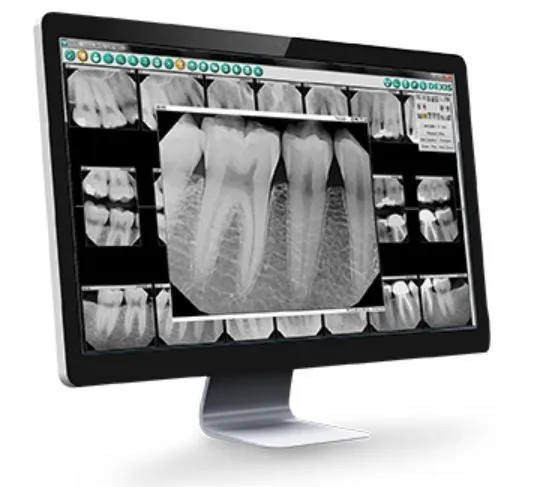 digital x-ray 