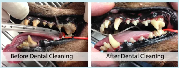 Before and after dental
