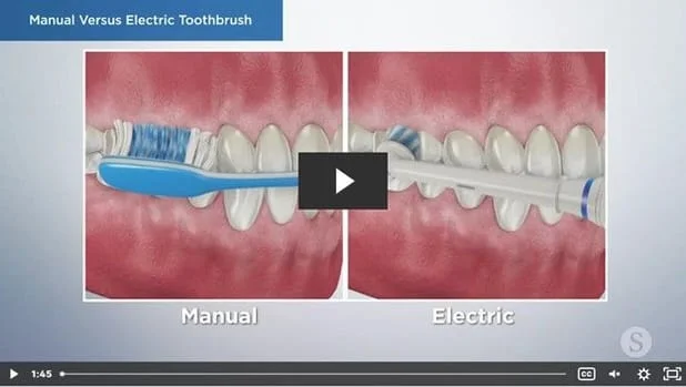 Manual Versus Electric Toothbrush