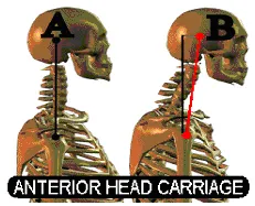 Anterior_Head.jpg