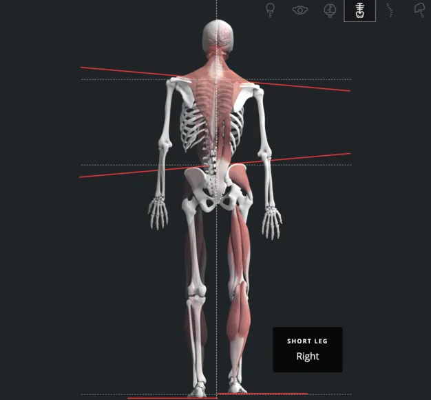 diagram of spine