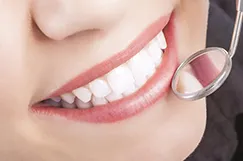 Tooth Whitening In Philadelphia, PA