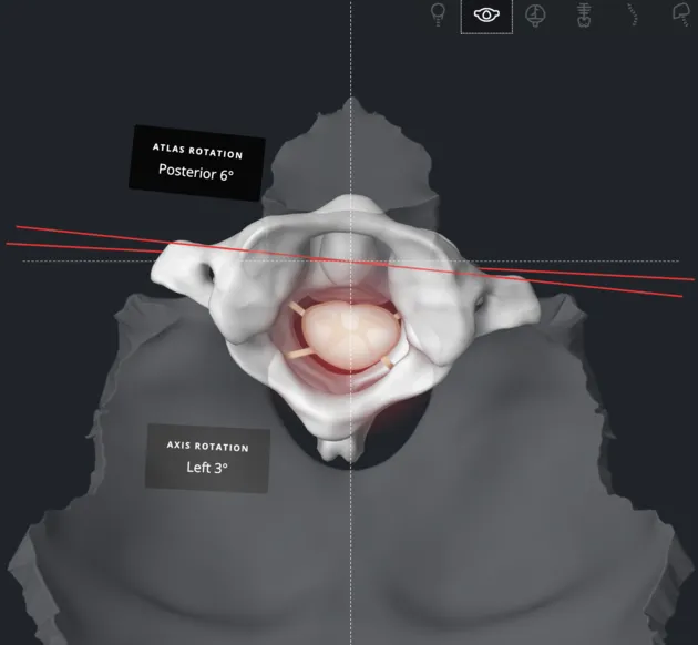 diagram of spine