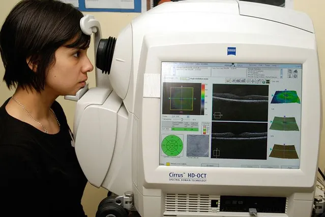 3 Optical Coherence Tomography of the Optic Nerve