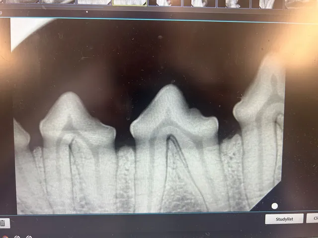 dental radiographs