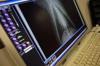 Xrays_II.jpg