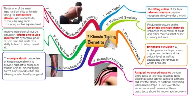 Kinesio Taping Overview