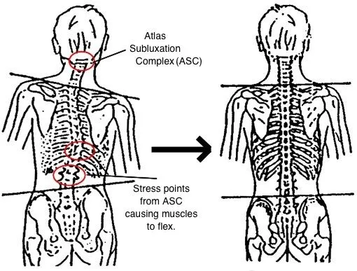 Back Pain Relief in Rochester, NY
