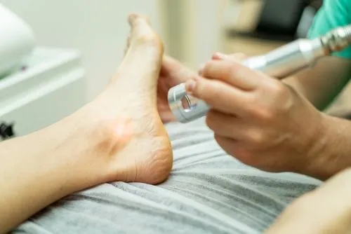 Podiatrist using laser treatment to manage ankle pain