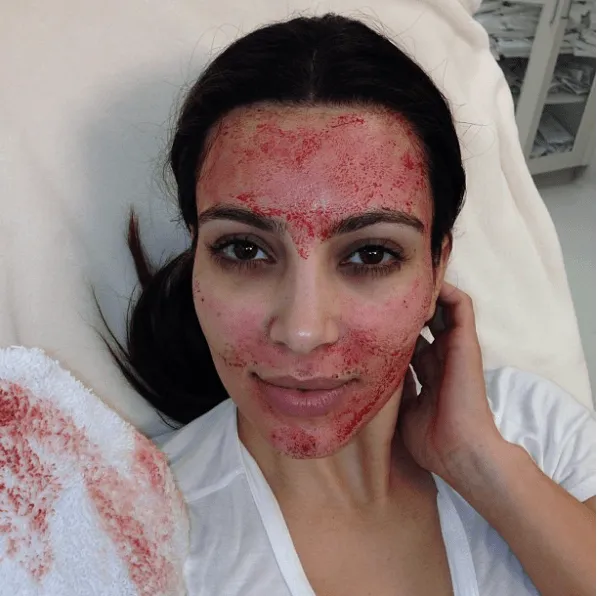 kim k microneedling