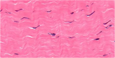 Microscopic Adhesion Fibrosis