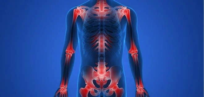 Muscle pain, joint function, bones