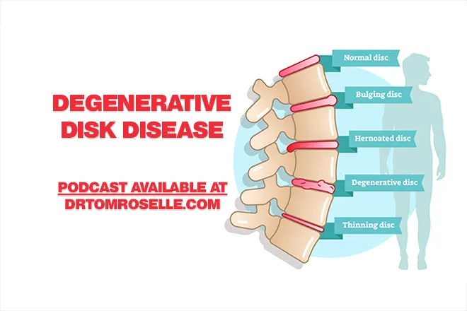 Degenerative Disk Disease