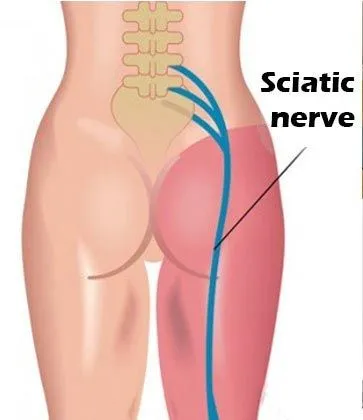 img-gitto-sciatic-nerve.jpg