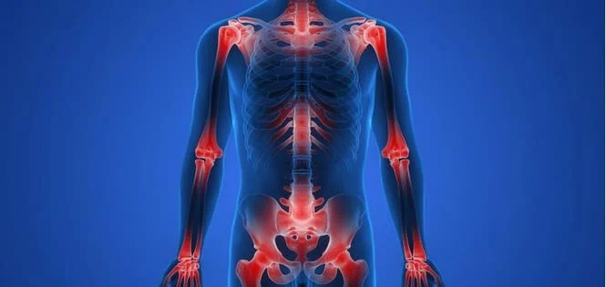 Bone Pain: Causes, Treatment, and When to See a Healthcare Provider