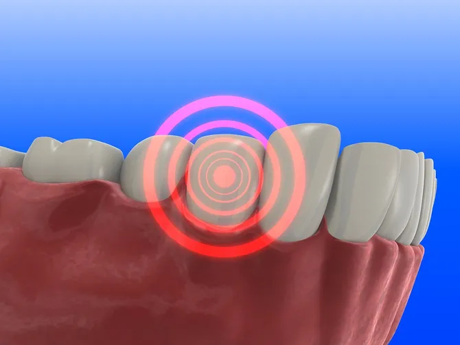 Tooth Pain needing Emergency Dentistry sunrise