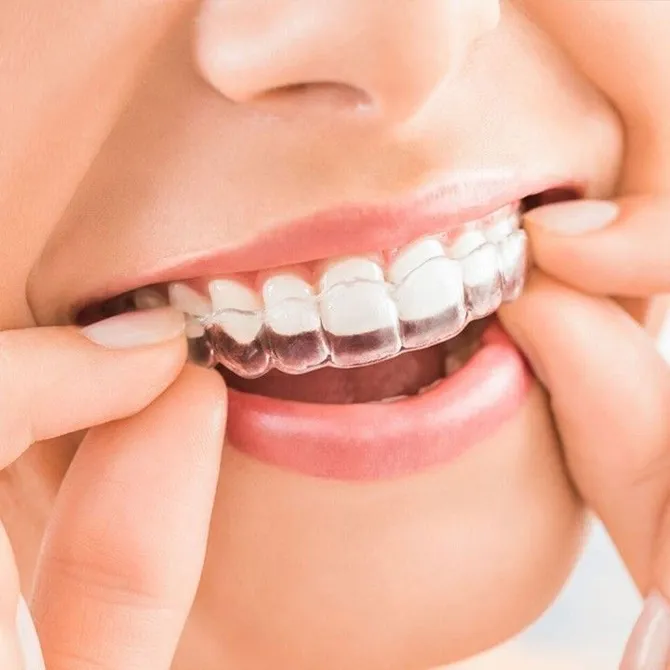Invisalign Boca Raton FL