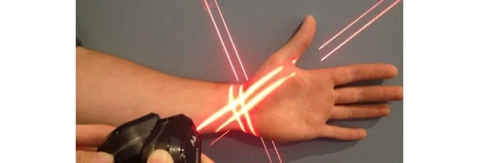 Erchonia Low Level Laser Therapy Wrist