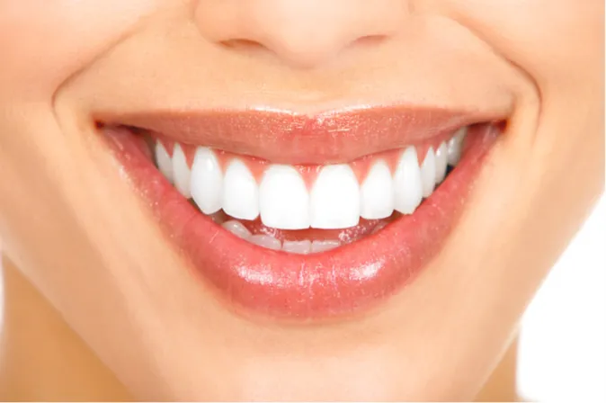 woman's smiling mouth, beautiful white straight teeth, veneers Reno, NV cosmetic dentistry