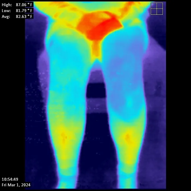 knee therm post