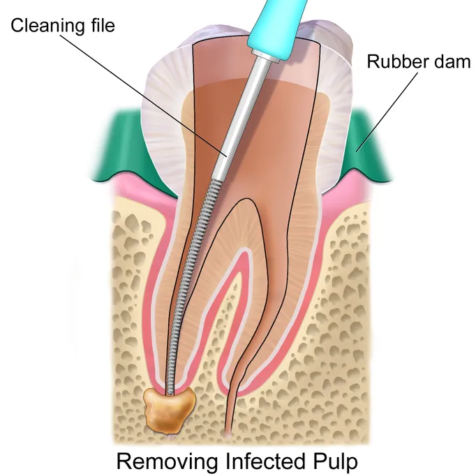 Endodontics