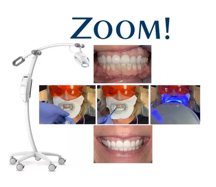Philips Zoom Teeth Whitening - Scottsdale, AZ Dentist | Healthy Smiles Dentistry