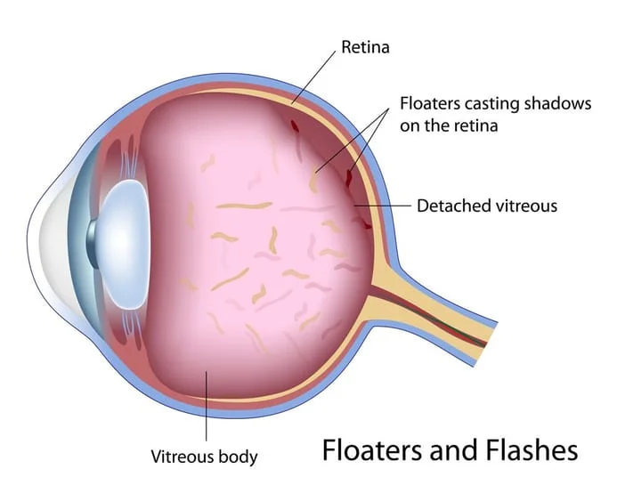 diagram of eyeball