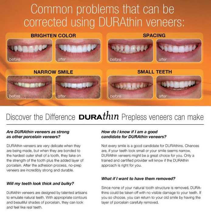 durathin veneers before and after