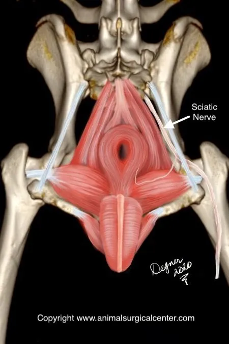 Sciatic nerve anatomy 3