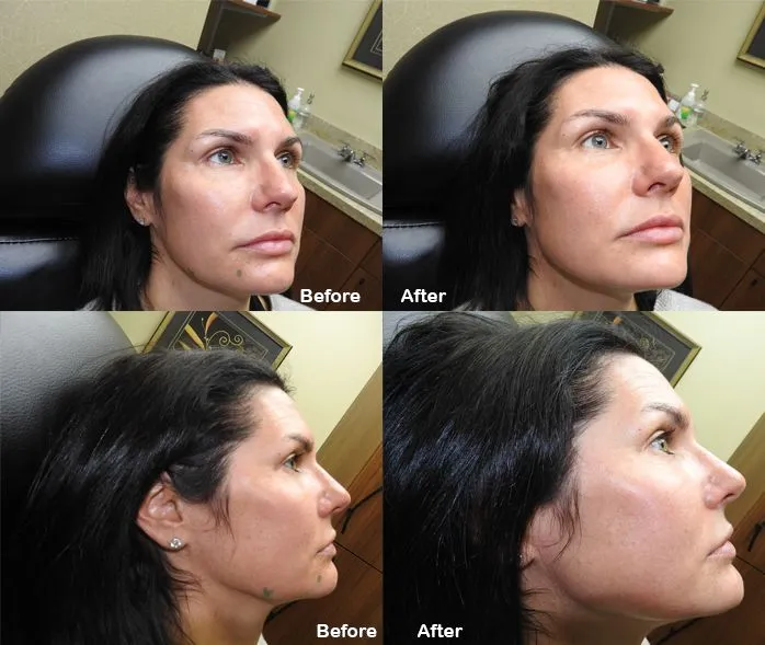 Before and After