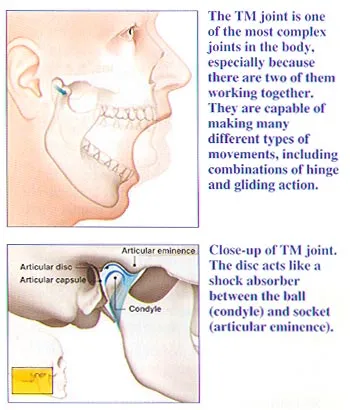 TMJ illustration