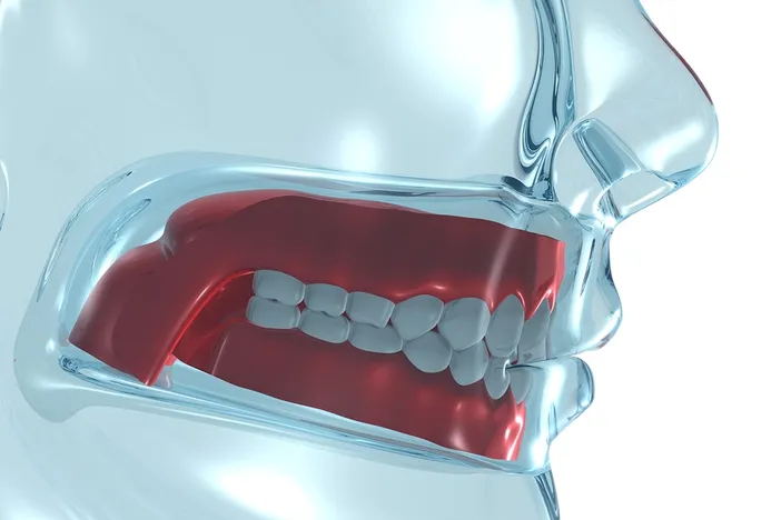 Animation of Dentures Greensboro, NC