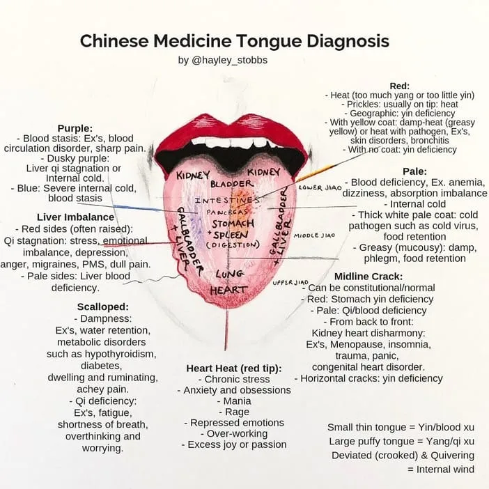 acupuncture-tongue-diagnosis