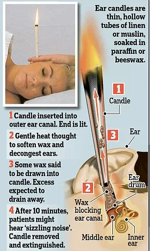 Ear candling 